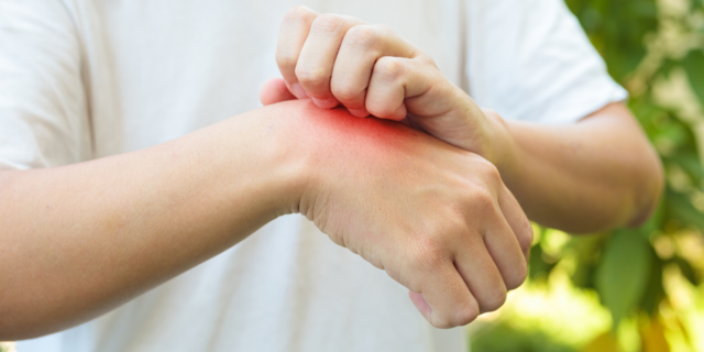 Discover the power of nutrient-rich cuisine in managing allergies while boosting your fitness journey. Unleash a healthier you with our expert insights.